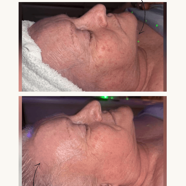 JoyGlowElite at Shades of Joy Esthetics in Lodi, CA