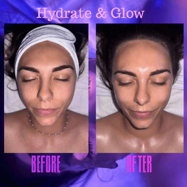 Signature Glow at Shades of Joy Esthetics in Lodi, CA