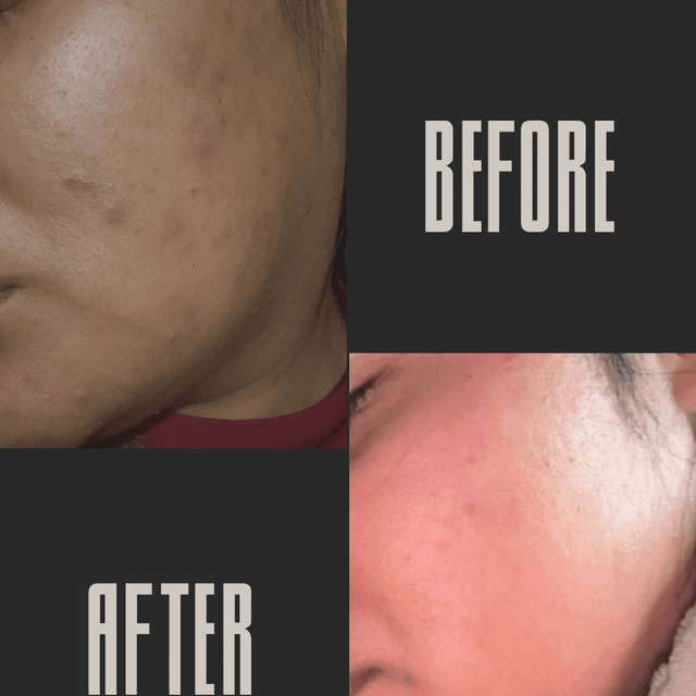 Calm Radiance at Shades of Joy Esthetics in Lodi, CA